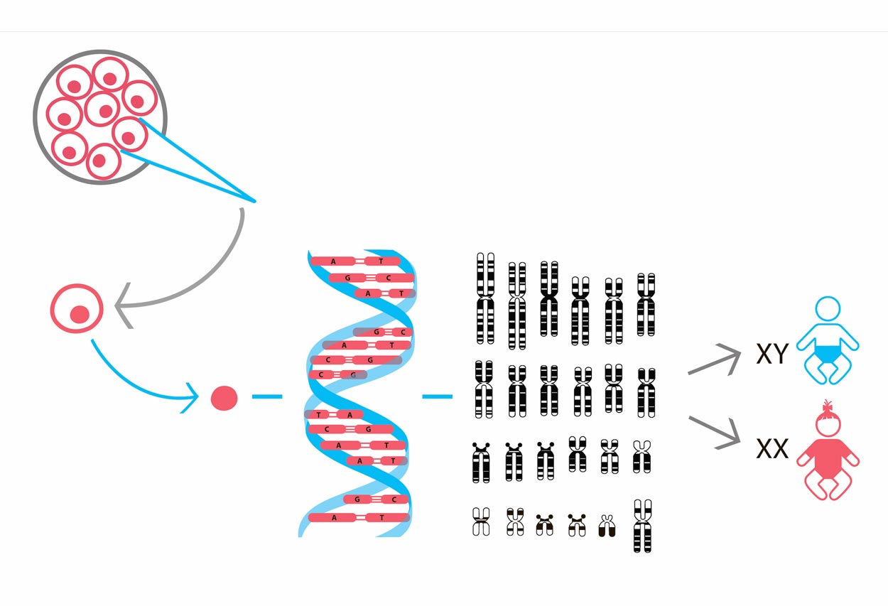 Patient's oocytes + donor's sperm + PGD (24 chromosomes) up to 8 embryos