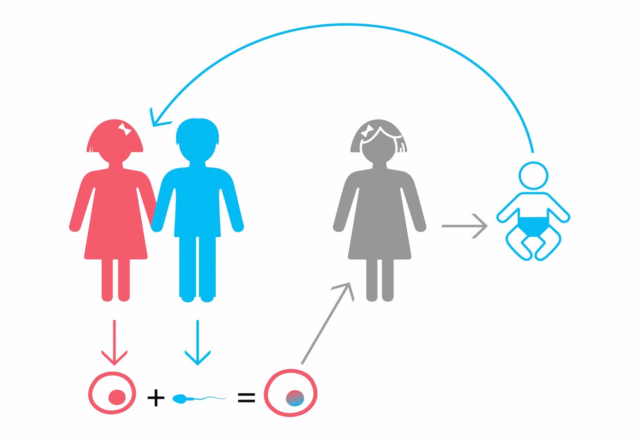 SM + patients' cells + PGD (24 chromosomes) up to 8 embryos