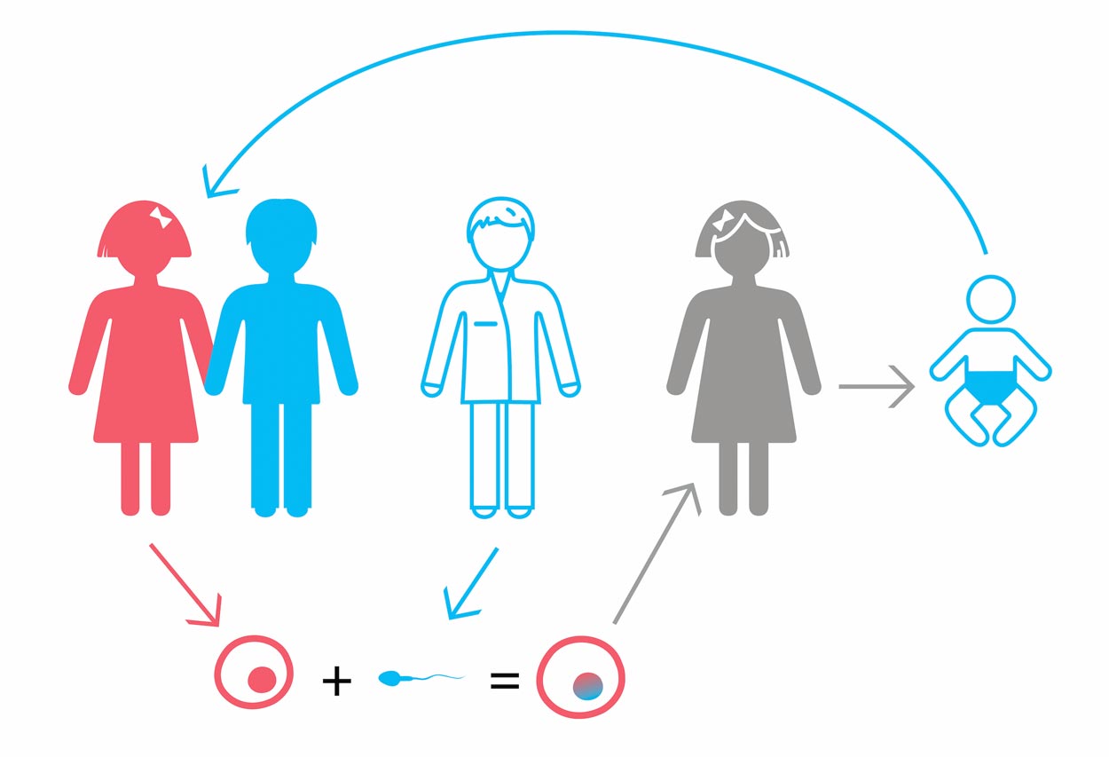 SM + patient's oocytes + donor's sperm +  PGD (24 chromosomes) up to 8 embryos